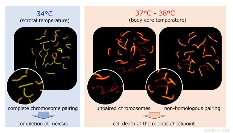 Testicular Warming & Spermatogenesis Failure: Understanding Male Infertility