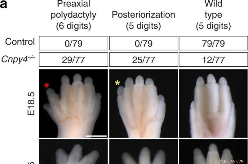 Gene Discovery Sheds Light on Embryo Development and Birth Defects