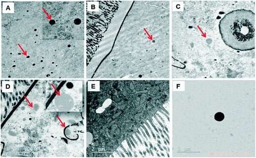 Microplastic Tracking: Journey Through the Intestine of a Living Organism
