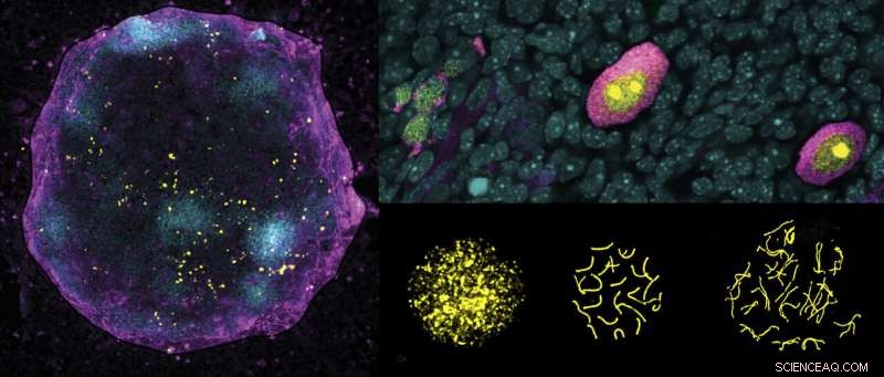 X Chromosome Regulation in Oocyte Development: A Critical Process