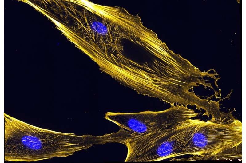 Understanding Plastins: New Insights into Cell Behavior and Disease