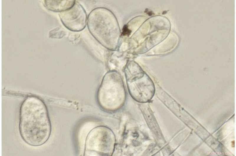 Aquatic Fungi: Unsung Heroes of Ecosystem Health & Conservation