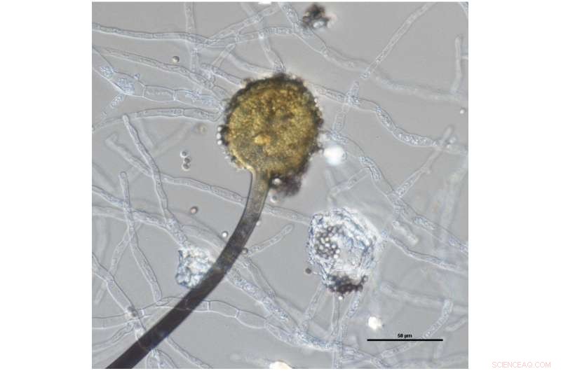 Aquatic Fungi: Unsung Heroes of Ecosystem Health & Conservation