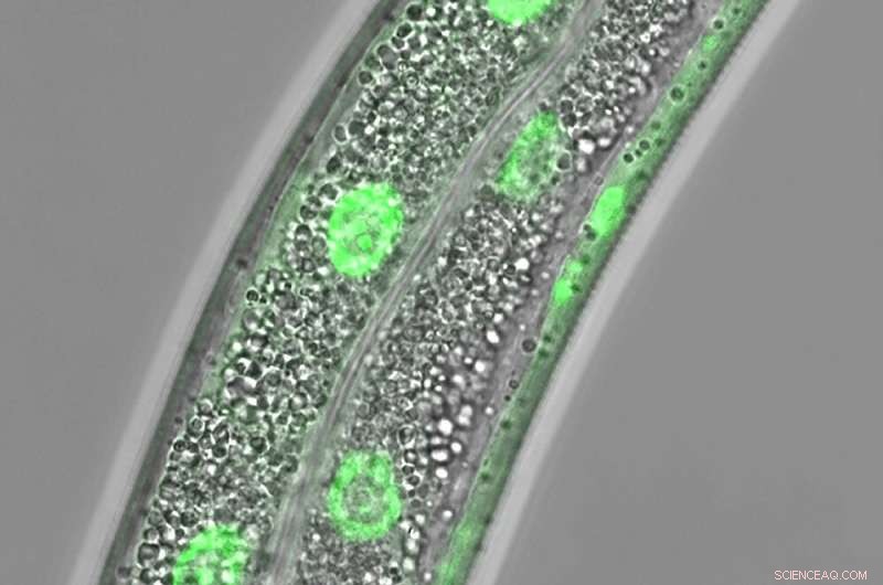 Lipid Depletion Signals: New Pathway Regulates Cellular Response
