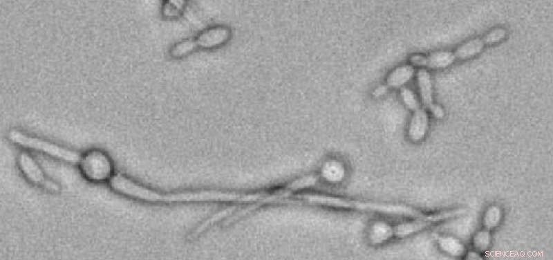 Understanding the Polymorphic Nature of Candida Albicans