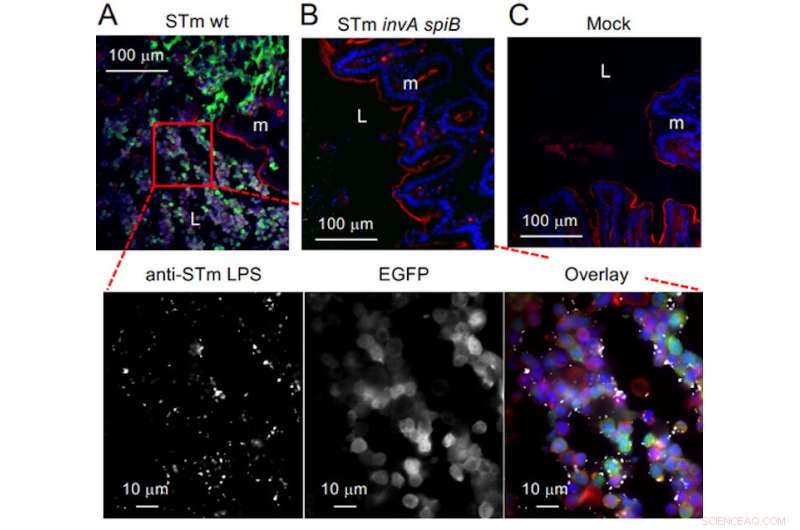 Probiotics Combat Gut Infections by Outcompeting Pathogens