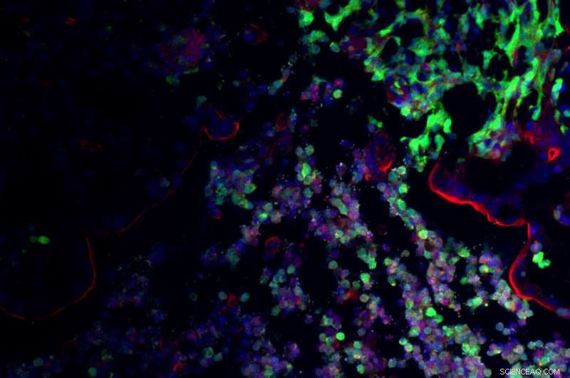 Probiotics Combat Gut Infections by Outcompeting Pathogens