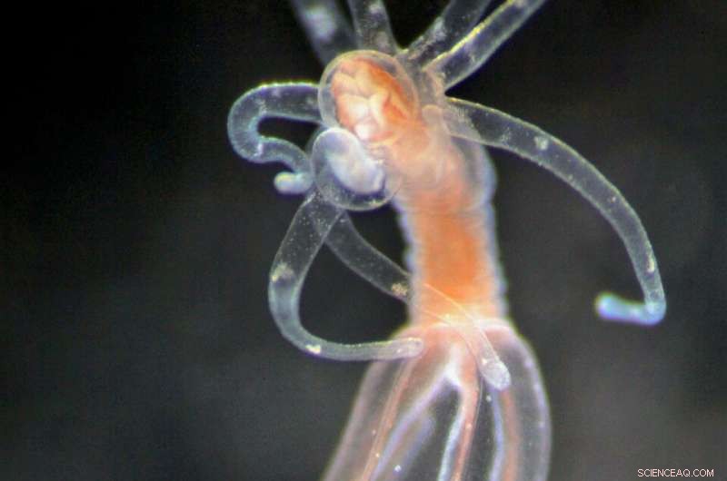 Jellyfish Stinging Cells: Unlocking the Secrets of Cell Type Evolution