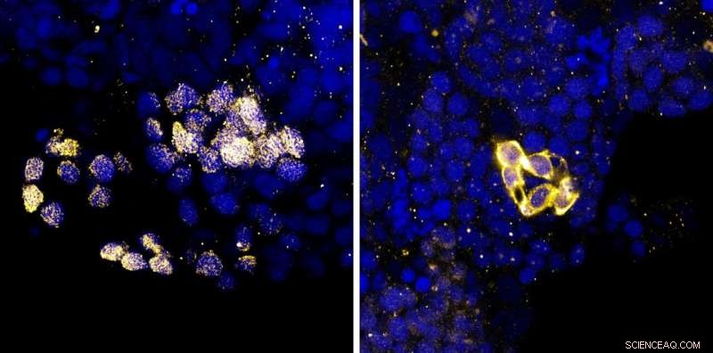 Bloom Syndrome Research: Novel Insights from Fish Models