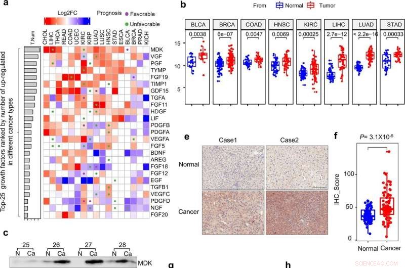 Midkine & AMPK: Understanding Growth Factor s Role in Cancer Progression