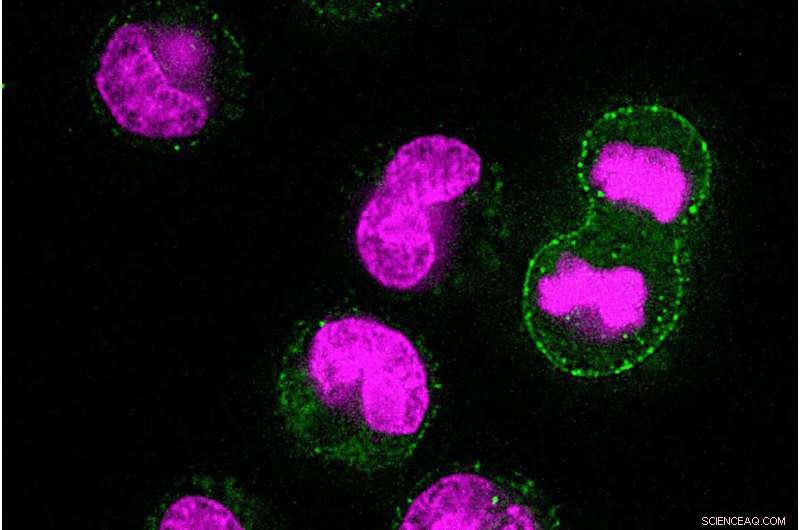 Cellular Housekeeping: Waste Removal Before Cell Division - MIT Study
