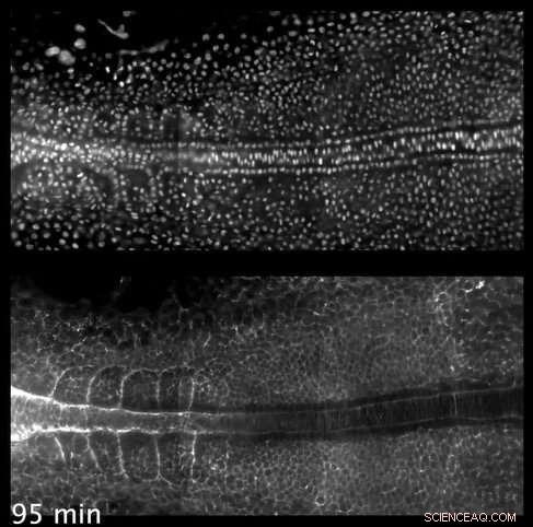 Surface Tension s Unexpected Role in Human Body Symmetry | Nature Study