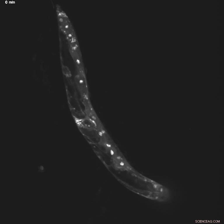 How Hunger Affects Behavior: New Insights from Worm Studies