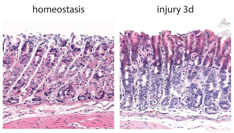 Stomach Stem Cells: Switching Roles After Injury - A Cellular Shift