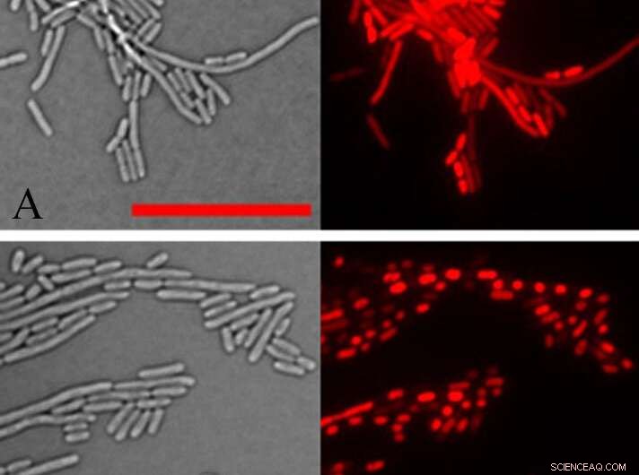Aberrant Protein Linked to Antibiotic Resistance Mechanism Discovered
