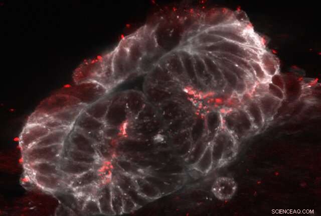 Cilia-Free Stem Cells: A Novel Approach to Understanding Ciliopathies