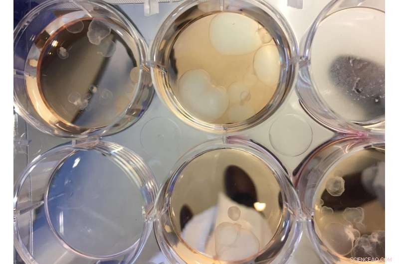 Cilia-Free Stem Cells: A Novel Approach to Understanding Ciliopathies