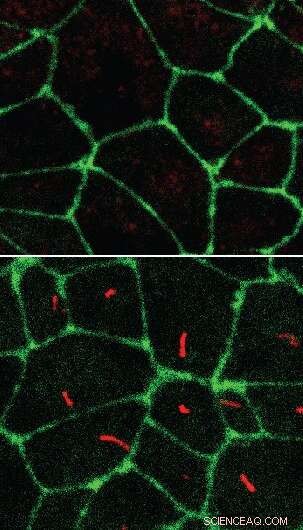 Cilia-Free Stem Cells: A Novel Approach to Understanding Ciliopathies