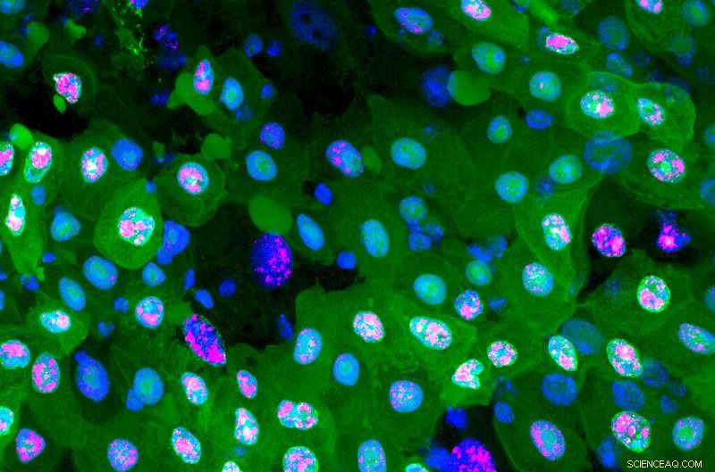 Erebosis: Scientists Discover Novel Cell Death Mechanism in Flies