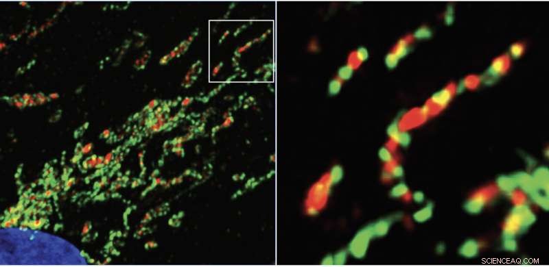 Protecting Mitochondria: Lipid Balance & Recycling for Cellular Health