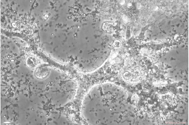New Soil Amoeba Species Discovered in Siberian Taiga