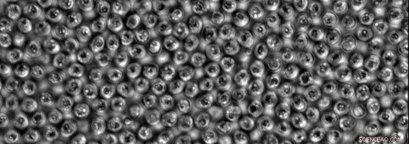 Understanding Cryptosporidium: Lifecycle & Impact on Human Health