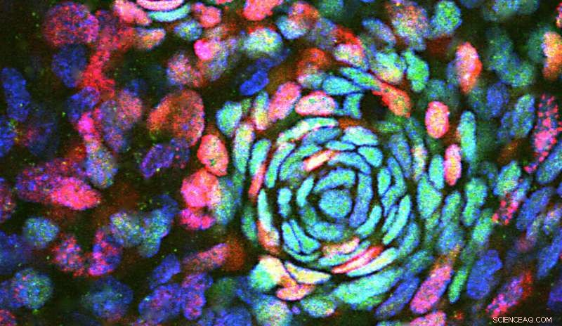 Research Advances Hair Follicle Development: A Step Towards Follicle Regeneration