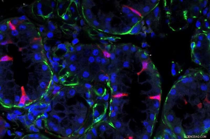 Ionocytes: A Novel Cell Type Holds Promise for Salivary Gland Restoration & Cystic Fibrosis Research