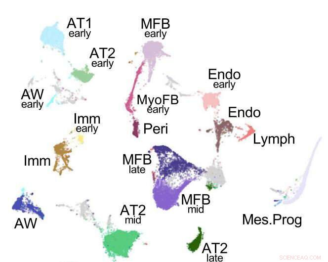 Postnatal Lung Development Atlas: A First Look at Lung Cell Evolution
