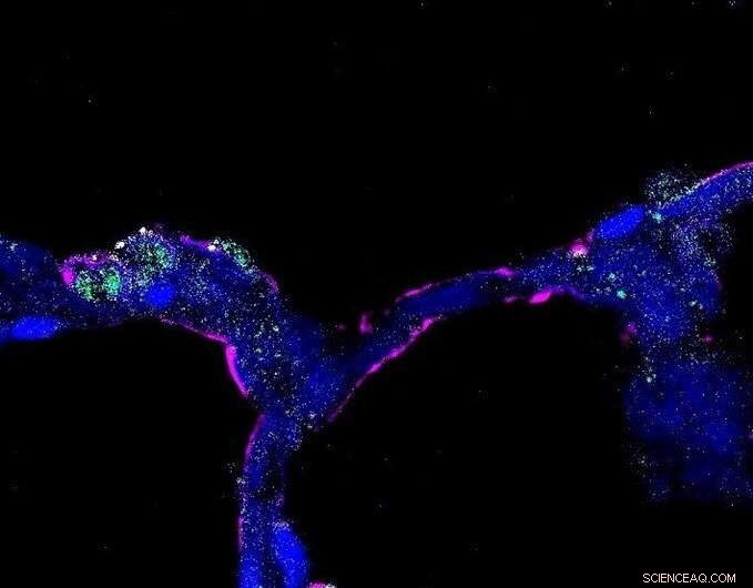 Postnatal Lung Development Atlas: A First Look at Lung Cell Evolution