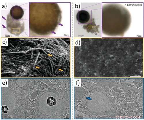 Actin s Role in Biosilica Architecture of Sponges: A Novel Study