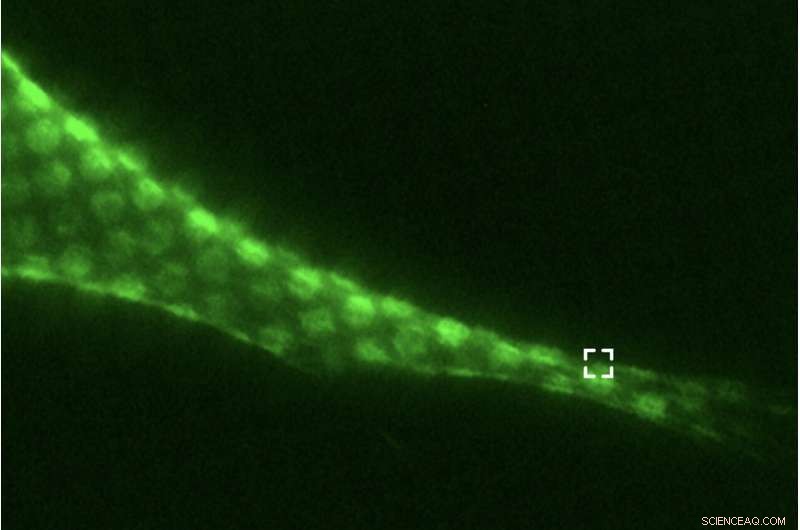 New Research Reveals Interconnectedness of Cytoskeletal Proteins