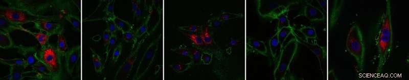 Reversing Skin Aging: Scientists Reprogram Cells for Youthful Function