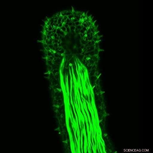 Gene Linking Hearing in Humans & Touch in Sea Anemones Discovered