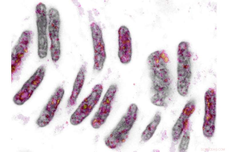 Novel Technique Reveals Gene Regulation Through DNA Packaging