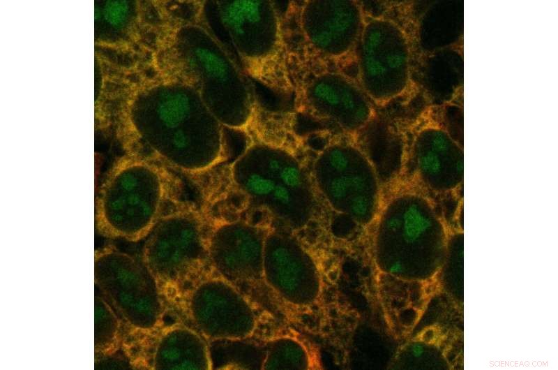 Key Complex Identified in Ribosome Biogenesis: Insights into Cellular Protein Production