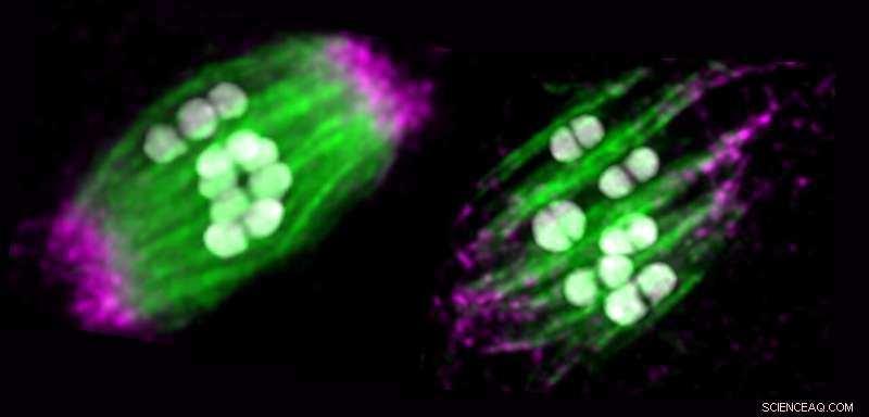 Dynein s Crucial Role in Egg Cell Spindle Organization & Preventing Errors