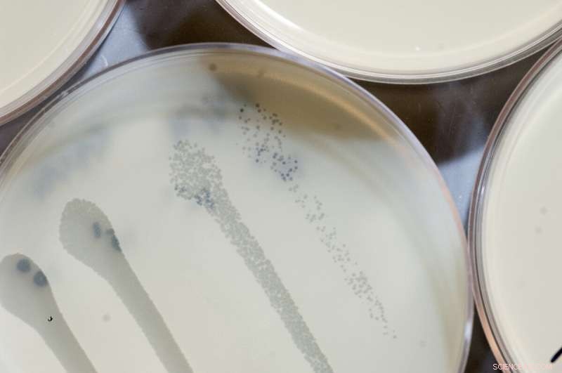 How Bacteria Self-Vaccinate to Defend Against Viral Invaders