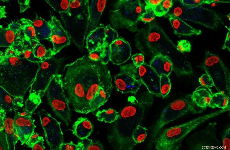 Cell pH Levels Disrupt TB Antibiotic Effectiveness: Francis Crick Institute Breakthrough