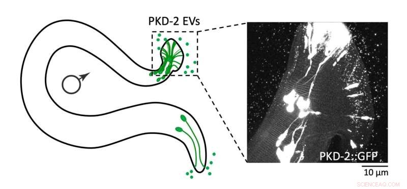 Tiny Bubbles, Once Dismissed as Cellular Debris, Unlock Key Insights into Disease Understanding and Treatment