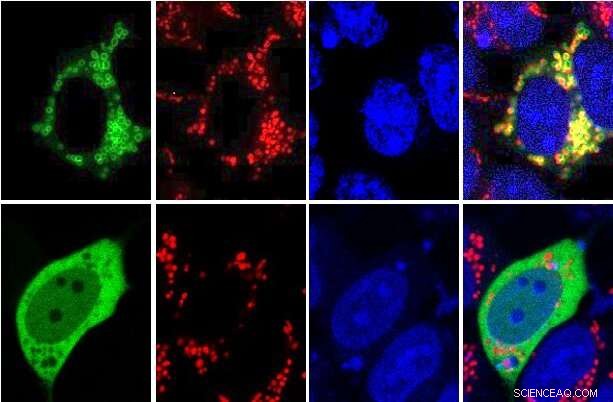 Hexokinase 1: New Insights into Glucose Metabolism and Cellular Localization