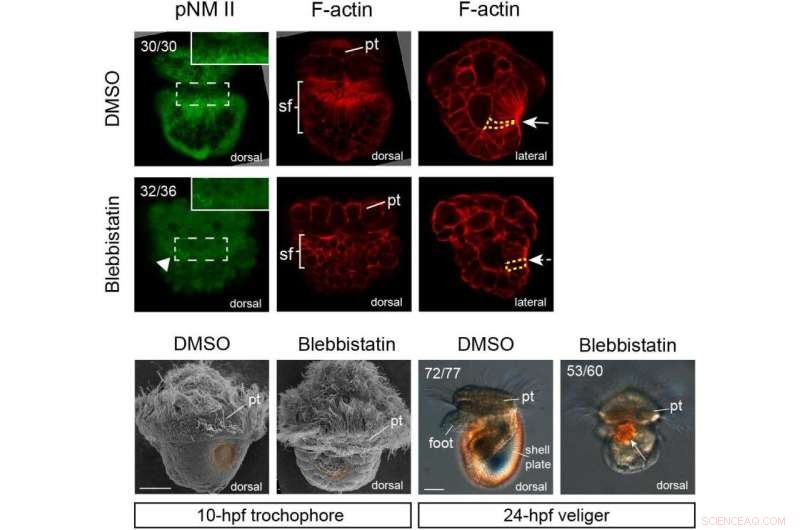 Myosin II Essential for Larval Shell Formation in Patellogastropods