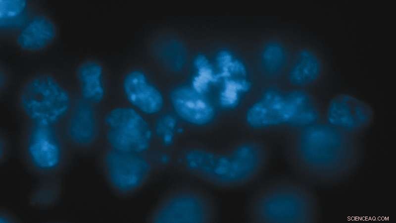 Gene Dicer s Role in Chromosome Stability and Cancer