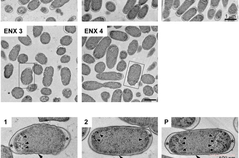 Shape Changes in Drug-Resistant Bacteria: A Novel Detection Method