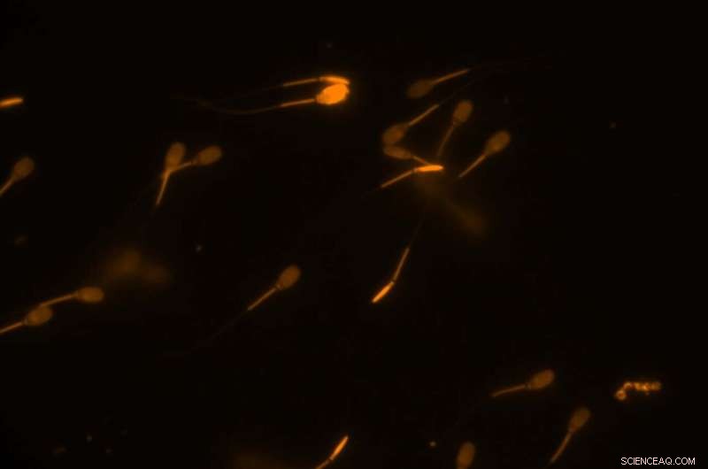 Sperm Membrane Protection: A Comparative Analysis of Antioxidant Strategies