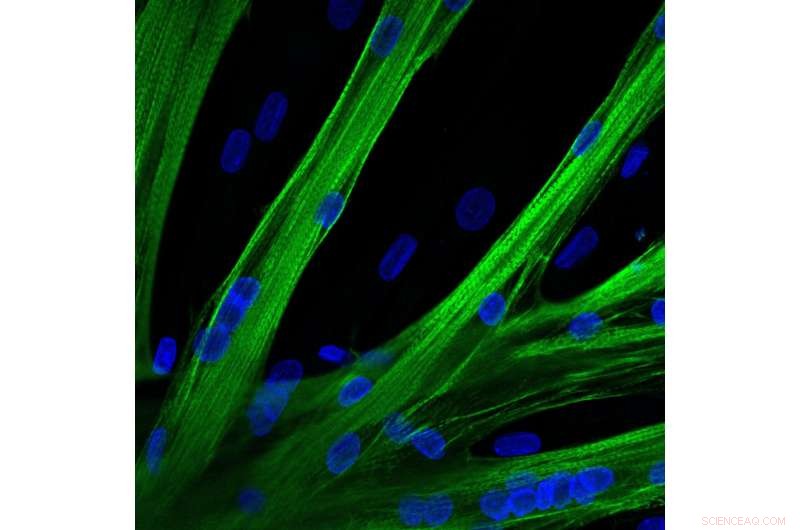 mRNA Therapy Shows Promise for Muscular Dystrophy Treatment