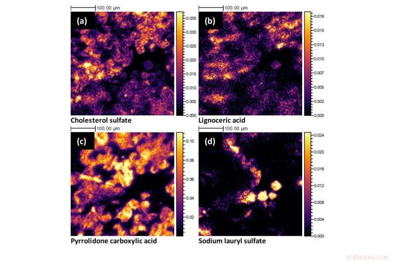 Detailed Skin Molecular Map Unlocks New Treatment Pathways