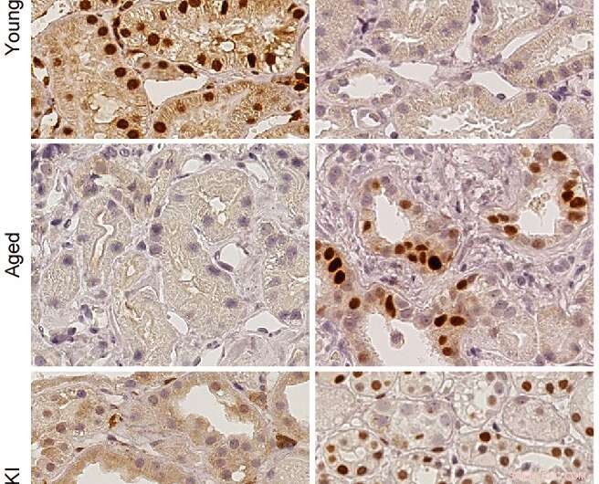 MondoA Protein: Potential Key to Age-Related Disease Prevention?