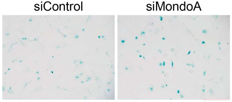 MondoA Protein: Potential Key to Age-Related Disease Prevention?
