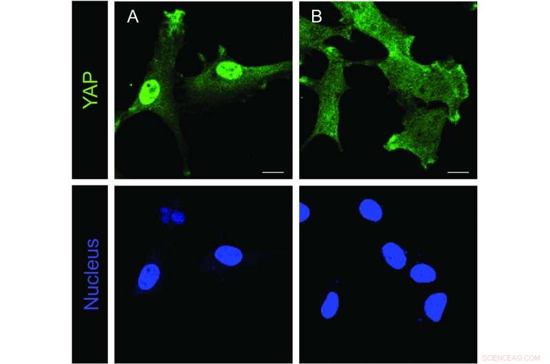 Importin-7: Key Protein Regulating Organ Growth & Development